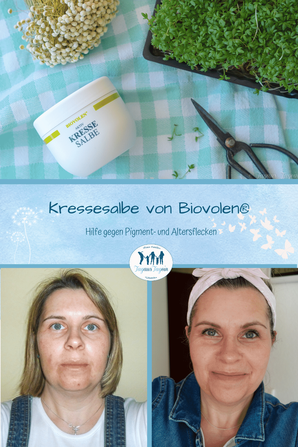KRESSESALBE VON BIOVOLEN® - Hilfe gegen Pigmentflecken